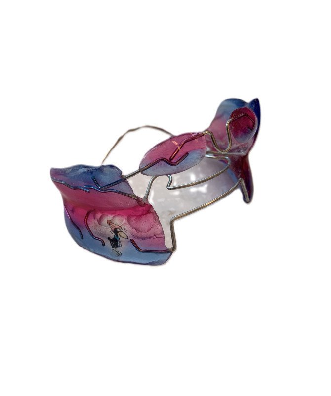 Removable braces For growing children