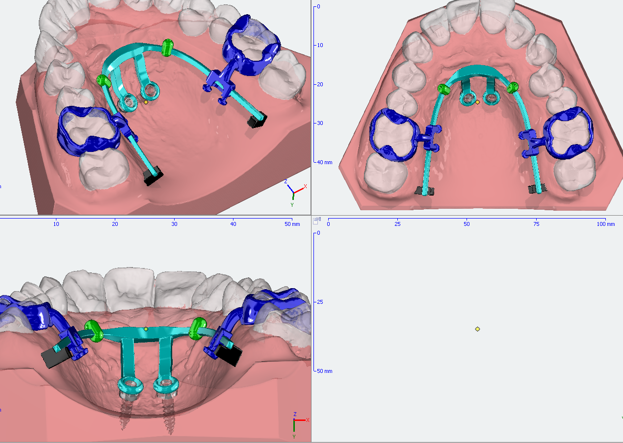 The digital orthodontic laboratory